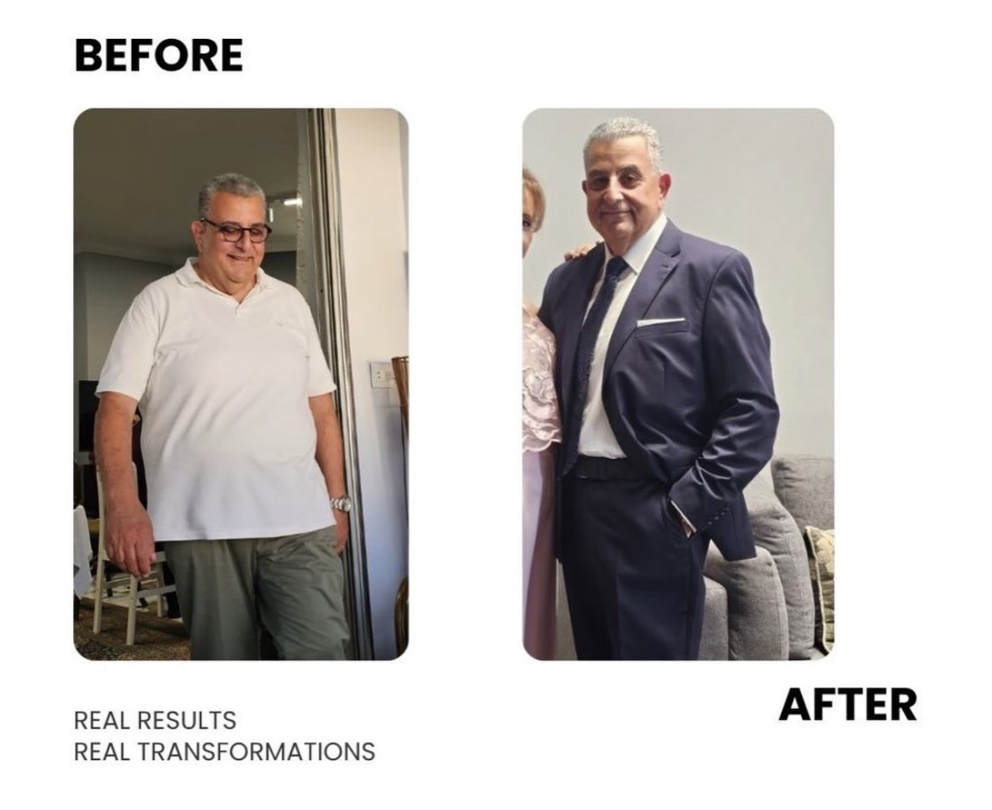 Male client before and after