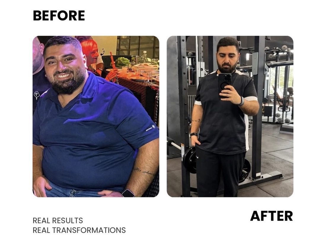Male client before and after