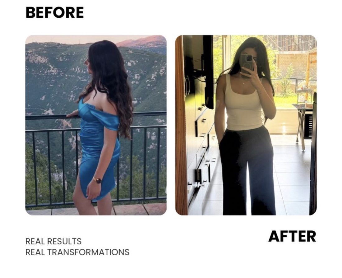 Female client before and after